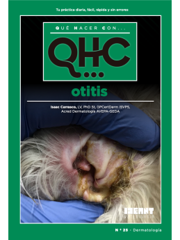 Qué Hacer Con... Otitis