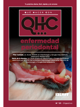 Qué Hacer Con... Enfermedad periodontal