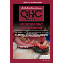 Qué Hacer Con... Enfermedad periodontal