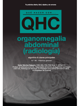 Qué Hacer Con...Organomegalia Abdominal (Radiología)