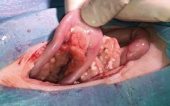imatge 10 pancreatitis